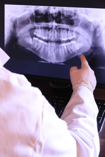 Best Dental Abscess Treatment in Mount Olive, MS