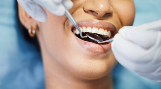 Best Dental Abscess Treatment in Mount Olive, MS